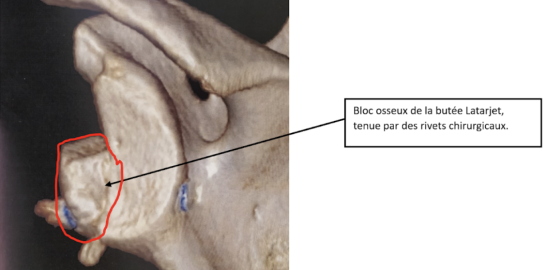 Capture d’écran 2023-09-06 à 09.18.12